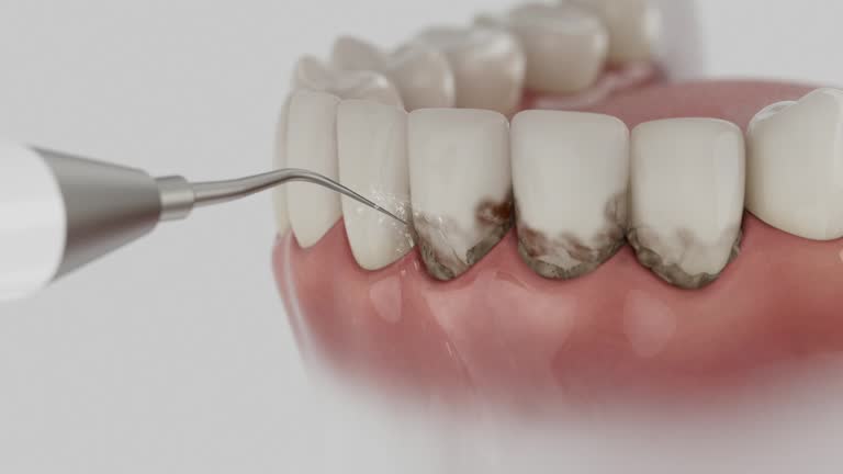Reliable Dental contractor in Morada, CA by Smile Center Dentistry